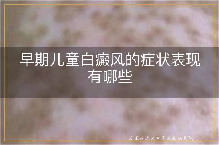 早期儿童白癜风的症状表现有哪些