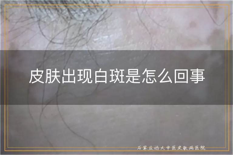皮肤出现白斑是怎么回事