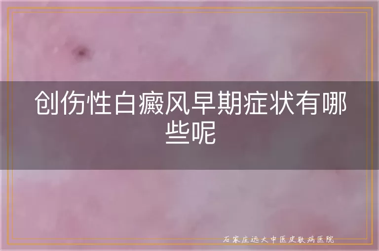 创伤性白癜风早期症状有哪些呢