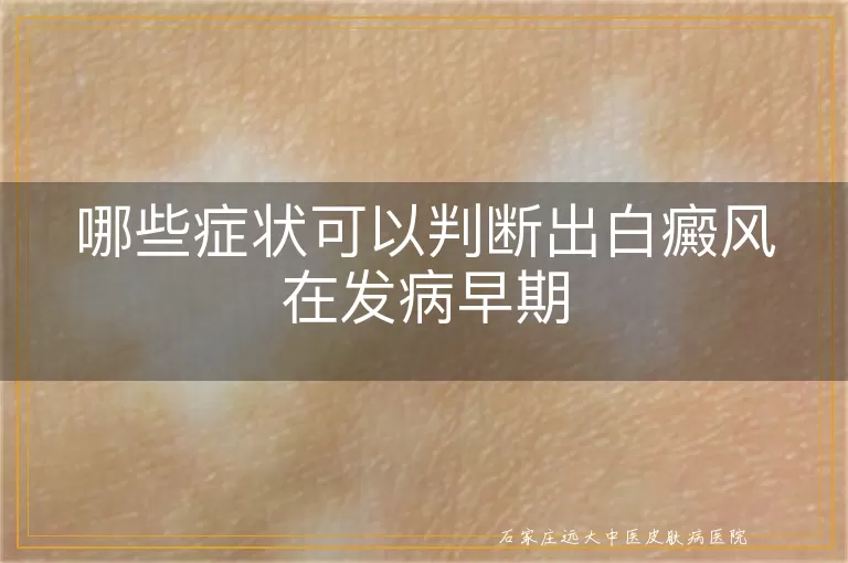 哪些症状可以判断出白癜风在发病早期