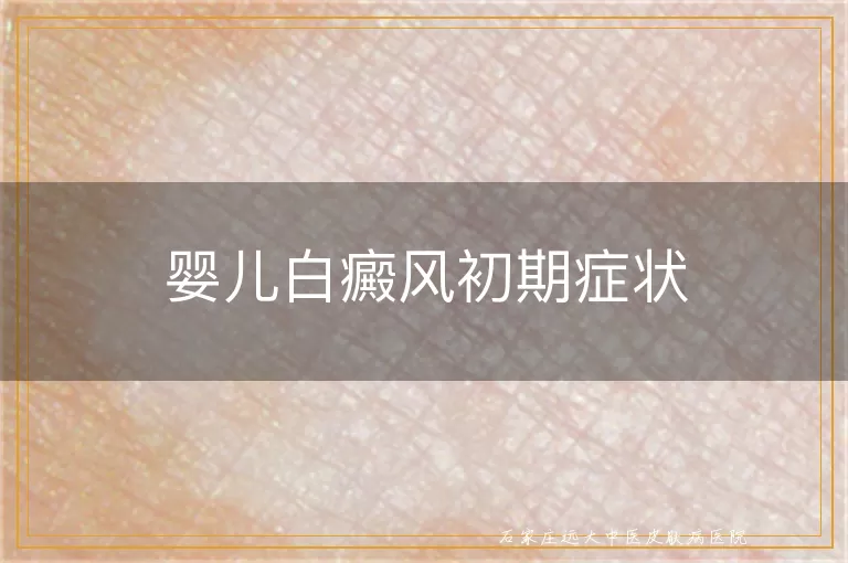 婴儿白癜风初期症状
