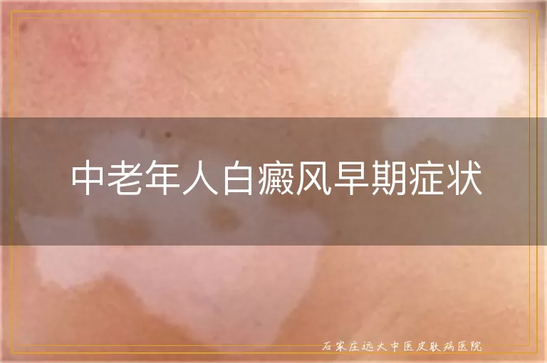 中老年人白癜风早期症状
