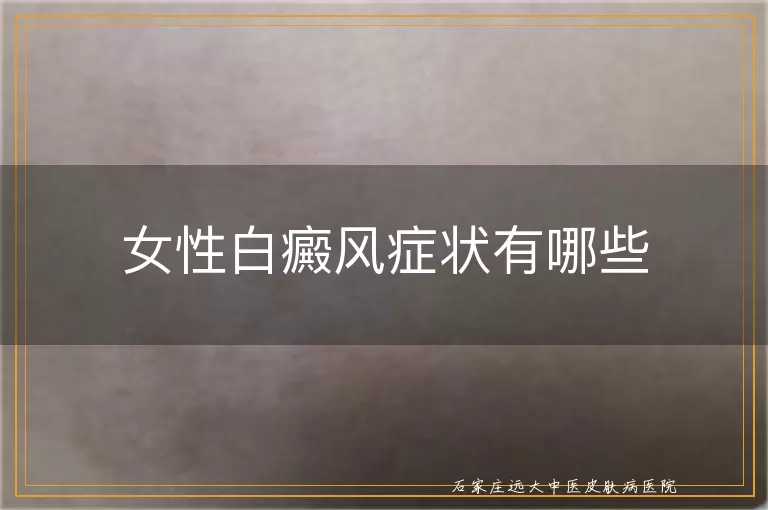 女性白癜风症状有哪些