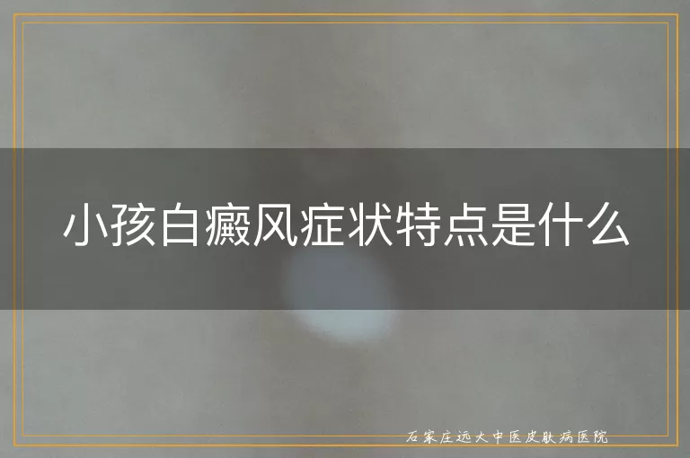 小孩白癜风症状特点是什么