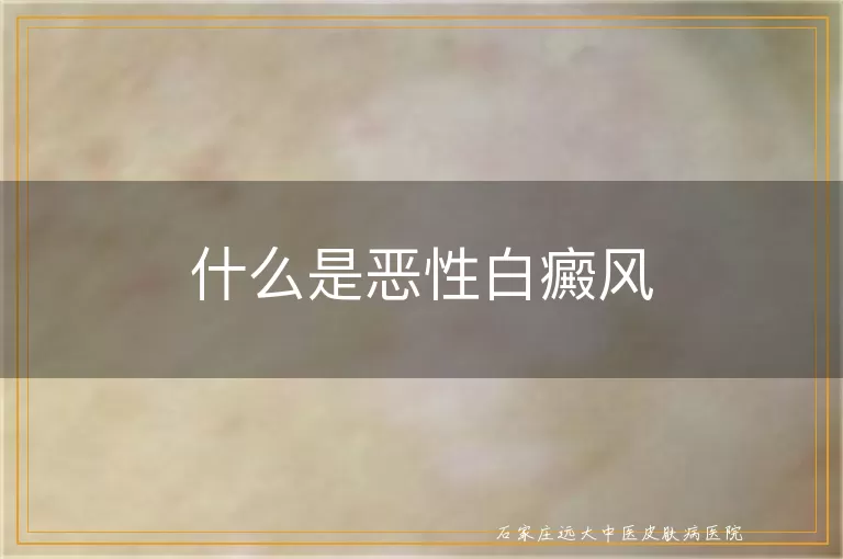 什么是恶性白癜风