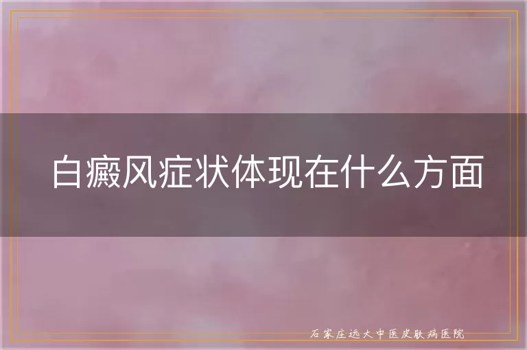 白癜风症状体现在什么方面