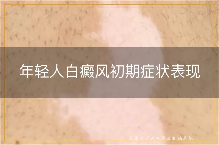 年轻人白癜风初期症状表现