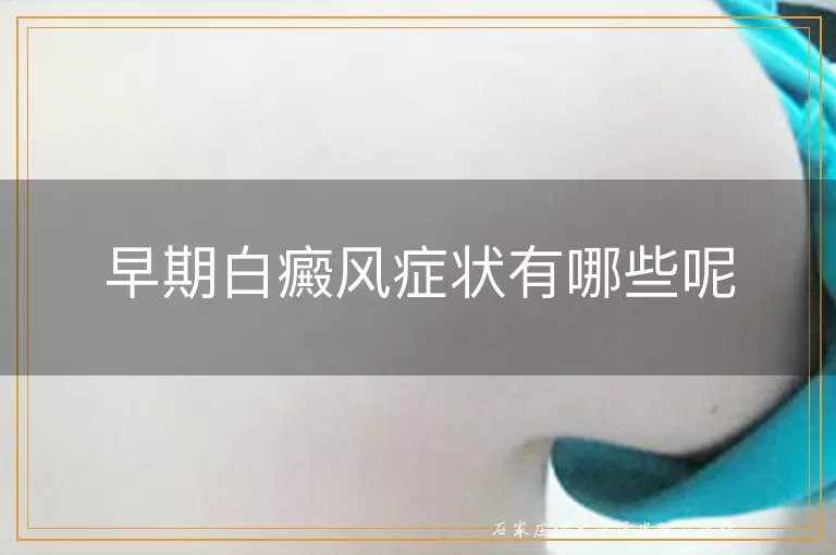 早期白癜风症状有哪些呢