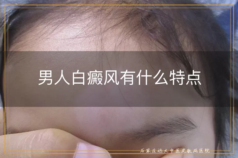 男人白癜风有什么特点