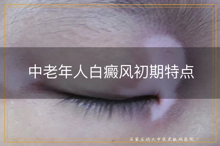 中老年人白癜风初期特点