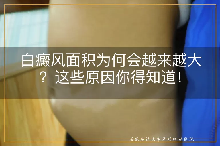 白癜风面积为何会越来越大？这些原因你得知道！