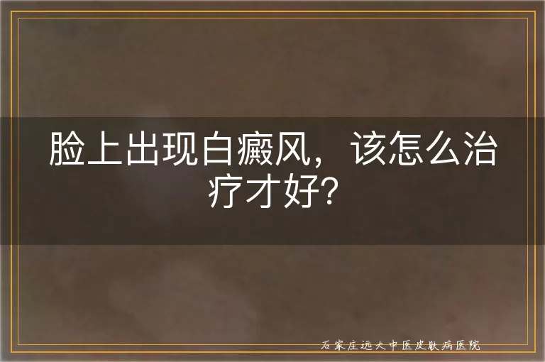 脸上出现白癜风，该怎么治疗才好？