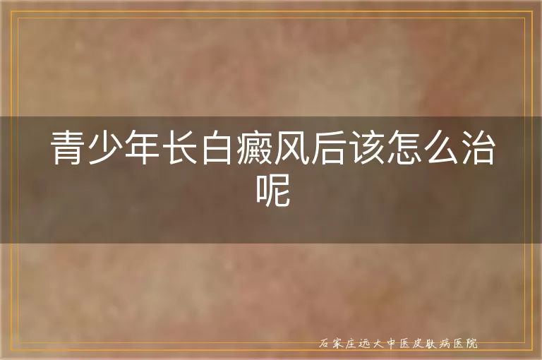 青少年长白癜风后该怎么治呢
