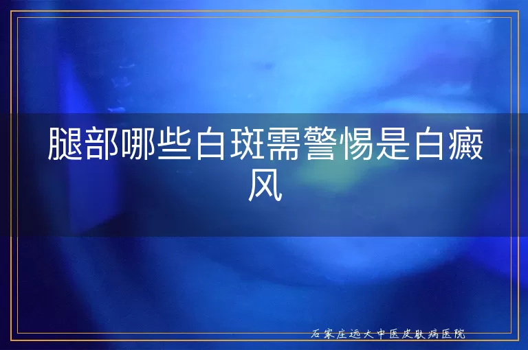 腿部哪些白斑需警惕是白癜风