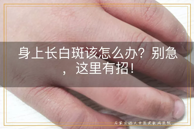身上长白斑该怎么办？别急，这里有招！