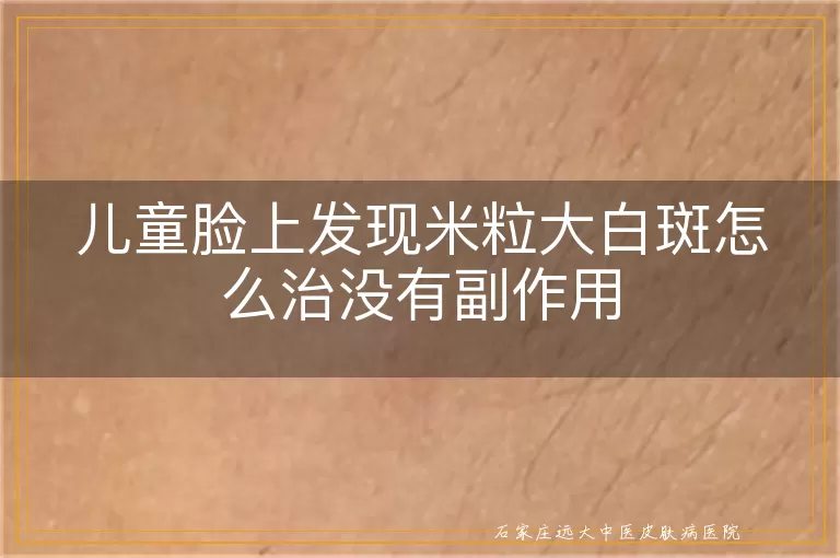 儿童脸上发现米粒大白斑怎么治没有副作用