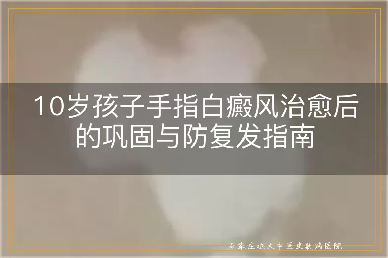 10岁孩子手指白癜风治愈后的巩固与防复发指南