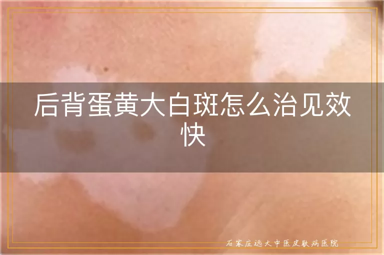 后背蛋黄大白斑怎么治见效快