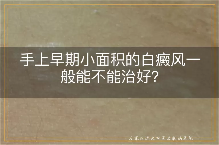 手上早期小面积的白癜风一般能不能治好？