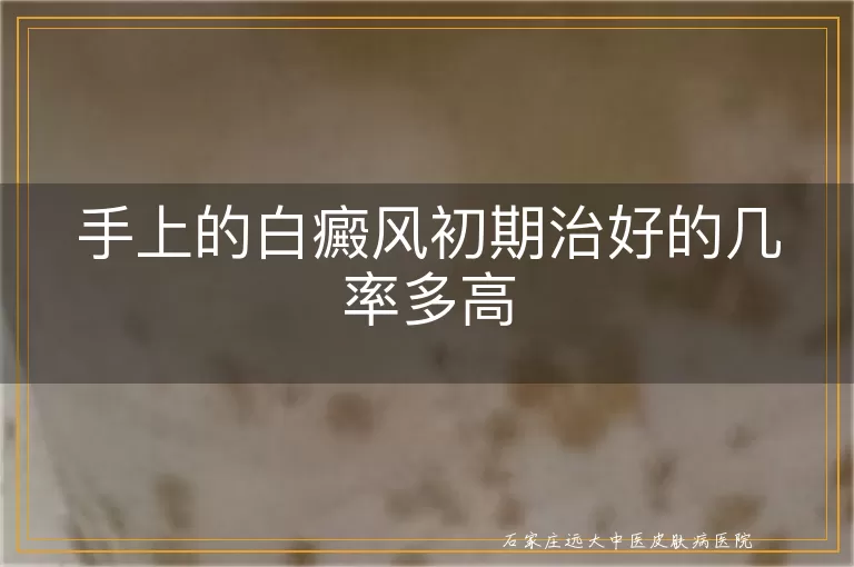 手上的白癜风初期治好的几率多高