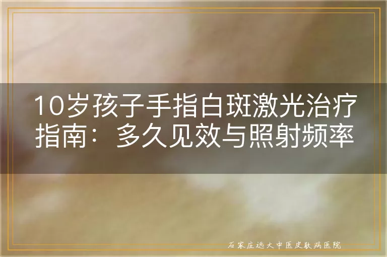 10岁孩子手指白斑激光治疗指南：多久见效与照射频率