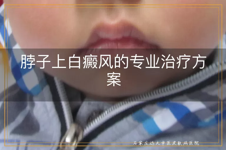 脖子上白癜风的专业治疗方案