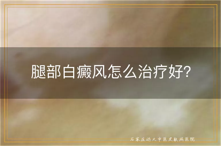 腿部白癜风怎么治疗好？
