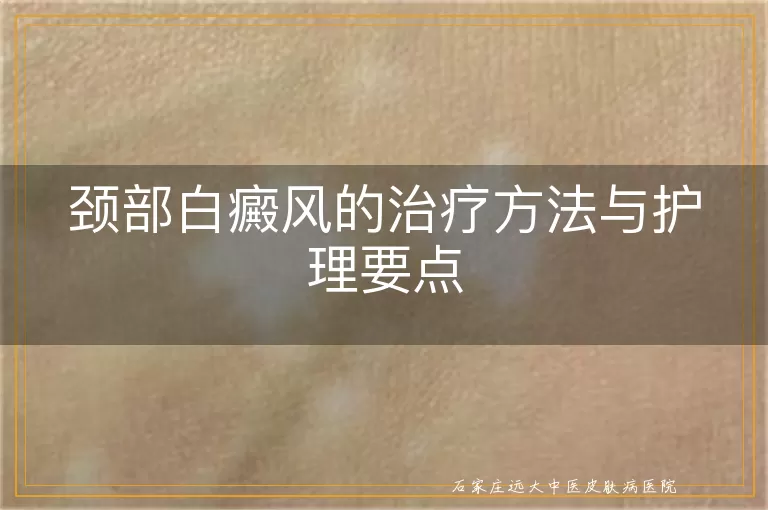 颈部白癜风的治疗方法与护理要点