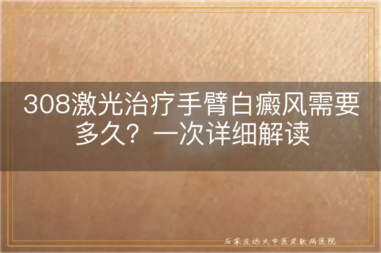 308激光治疗手臂白癜风需要多久？一次详细解读