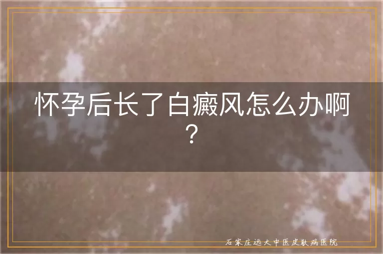 怀孕后长了白癜风怎么办啊？