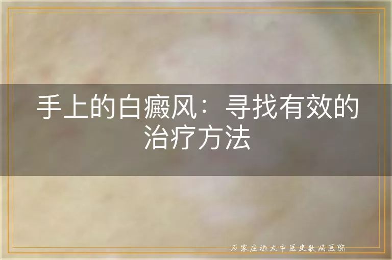 手上的白癜风：寻找有效的治疗方法
