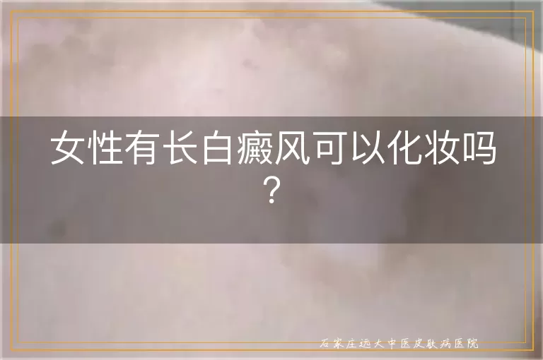 女性有长白癜风可以化妆吗？
