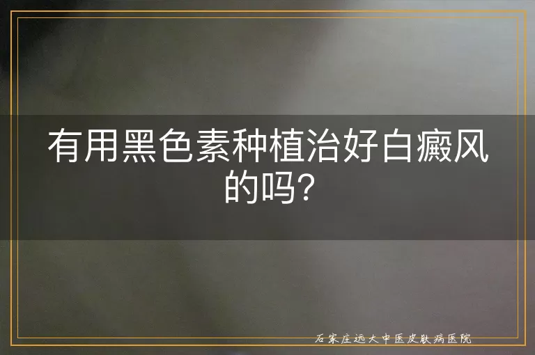 有用黑色素种植治好白癜风的吗？