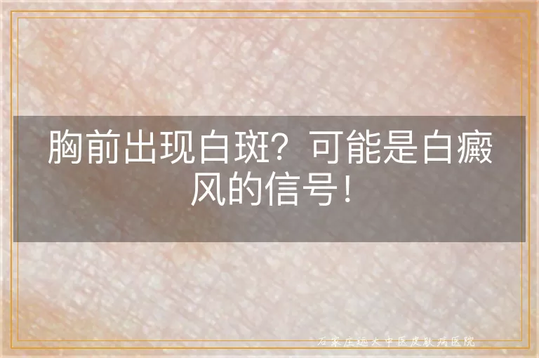 胸前出现白斑？可能是白癜风的信号！
