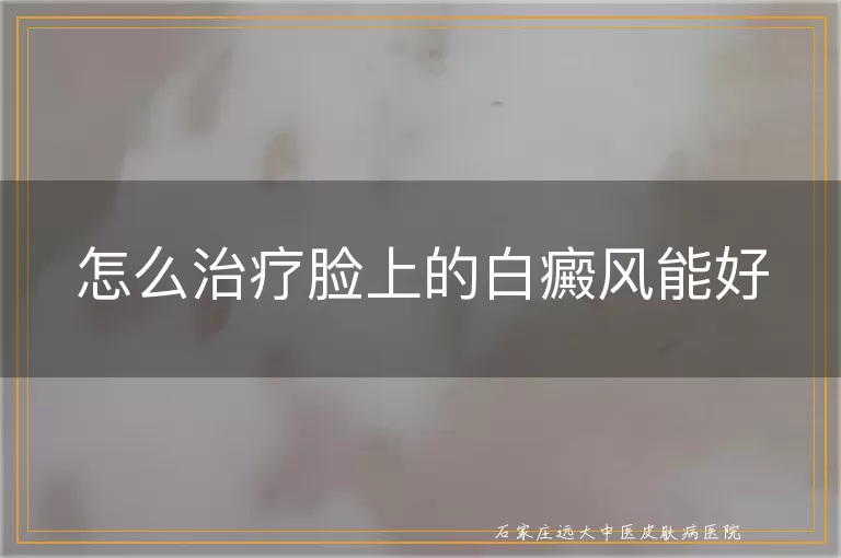 怎么治疗脸上的白癜风能好