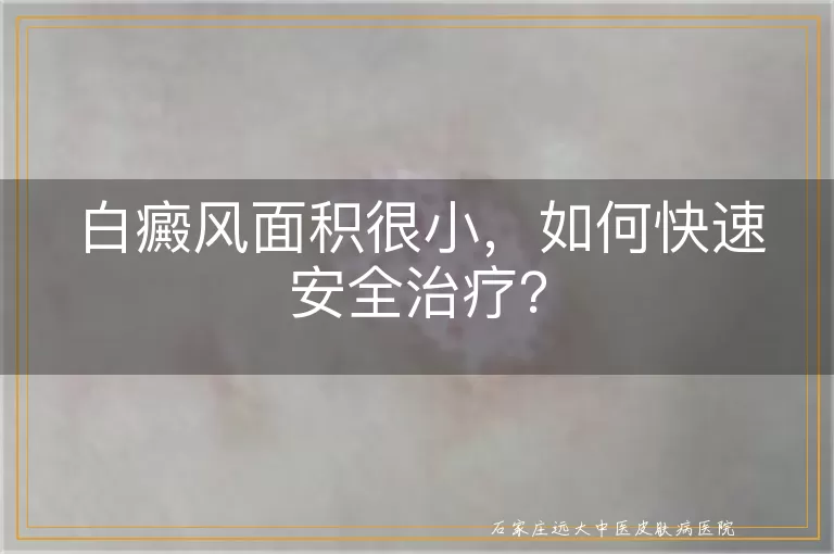 白癜风面积很小，如何快速安全治疗？