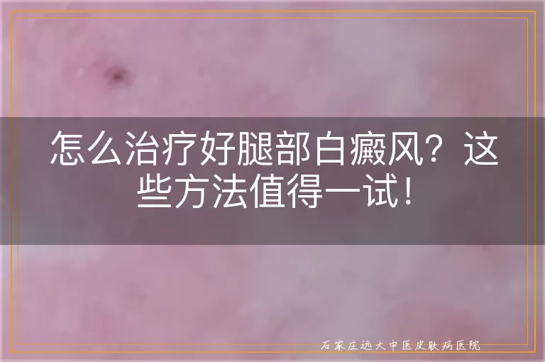 怎么治疗好腿部白癜风？这些方法值得一试！