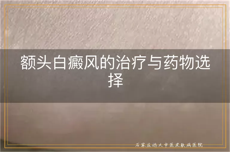额头白癜风的治疗与药物选择