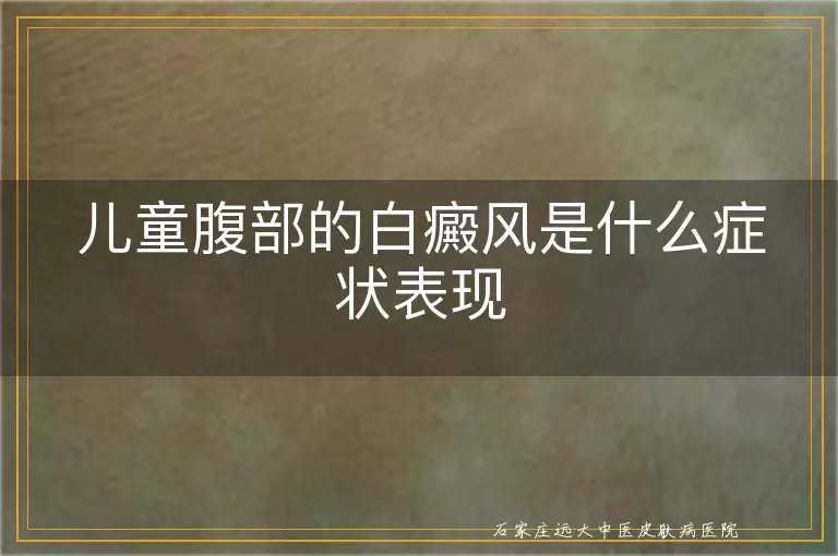 儿童腹部的白癜风是什么症状表现