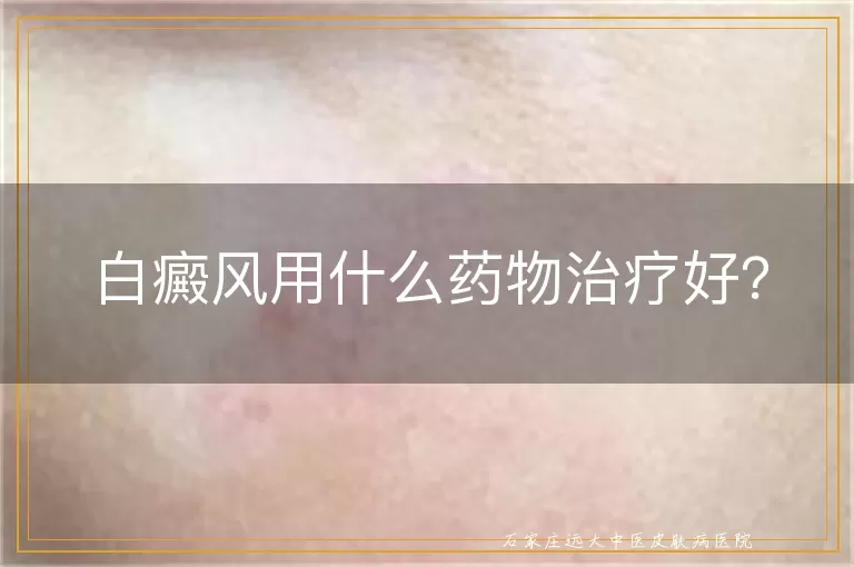 白癜风用什么药物治疗好？