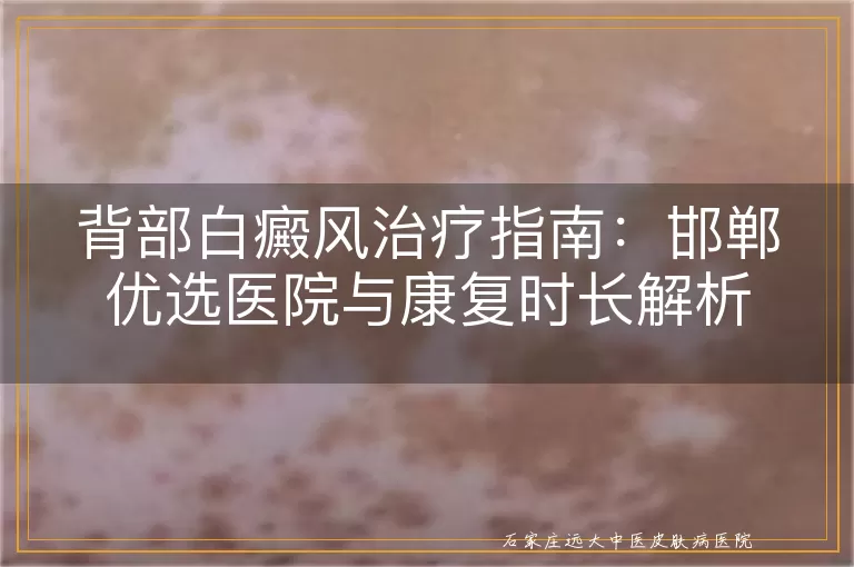 背部白癜风治疗指南：邯郸优选医院与康复时长解析