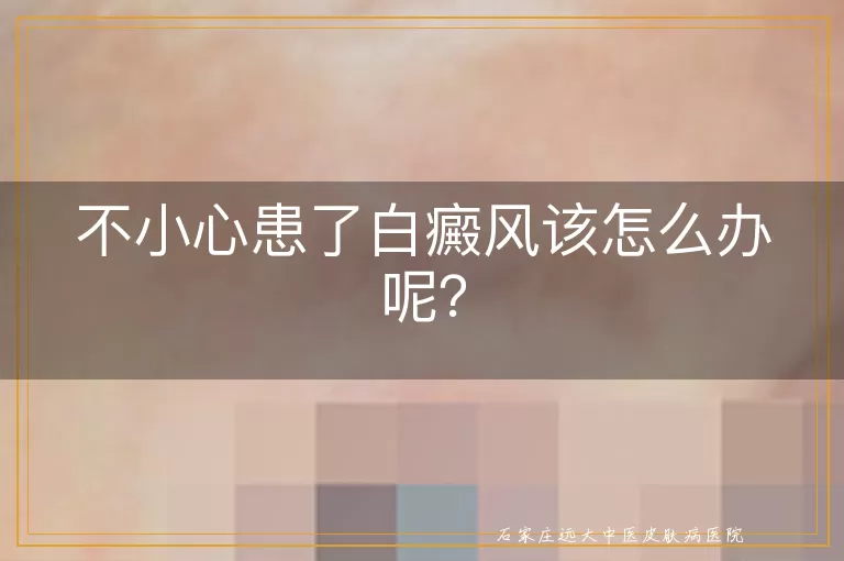 不小心患了白癜风该怎么办呢？