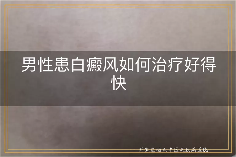 男性患白癜风如何治疗好得快