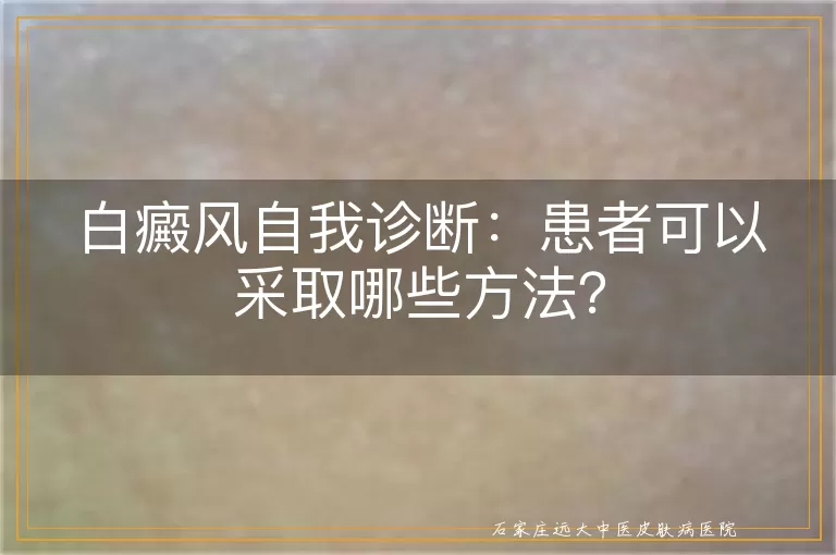 白癜风自我诊断：患者可以采取哪些方法？