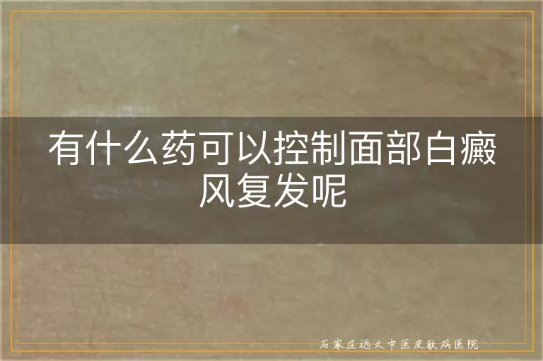 有什么药可以控制面部白癜风复发呢