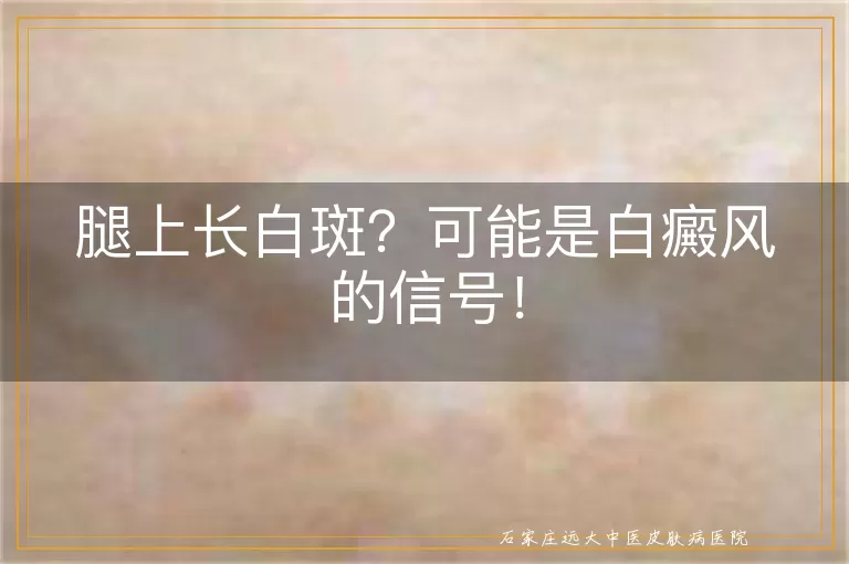 腿上长白斑？可能是白癜风的信号！