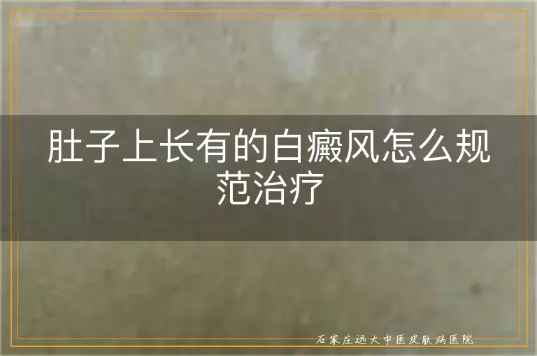 肚子上长有的白癜风怎么规范治疗