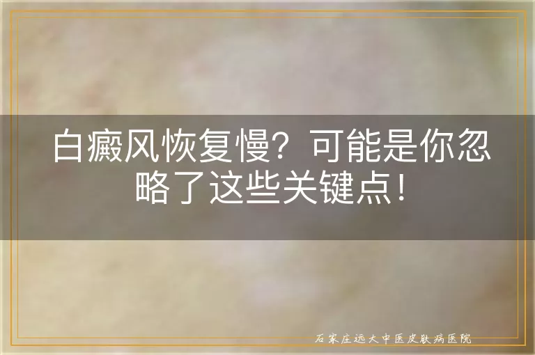 白癜风恢复慢？可能是你忽略了这些关键点！
