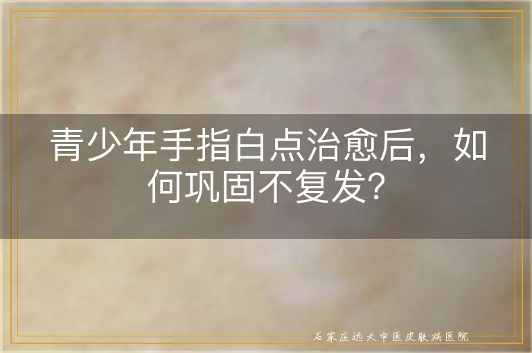 青少年手指白点治愈后，如何巩固不复发？
