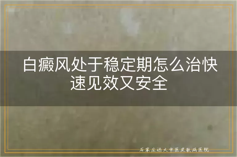 白癜风处于稳定期怎么治快速见效又安全